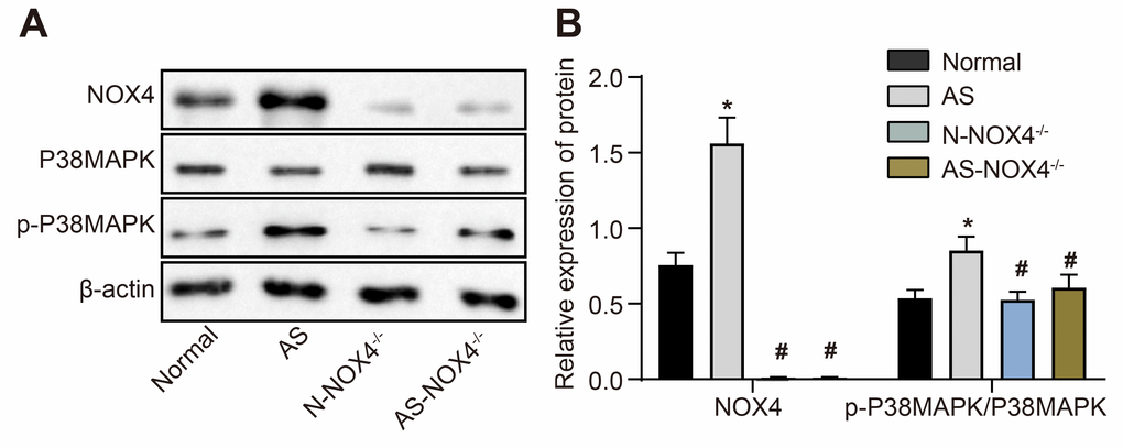 The protein expression of NOX4 and ratio of p-p38 MAPK/p38 MAPK are upregulated in coronary artery tissues of AS mice. (A) The protein expressions of NOX4, p38 MAPK and p-p38 MAPK were detected by Western blot; (B) Statistical comparison of NOX4, p38 MAPK and p-p38 MAPK protein expressions among four groups; The data were analyzed by one-way ANOVA with Tukey's test; n = 10; * p 