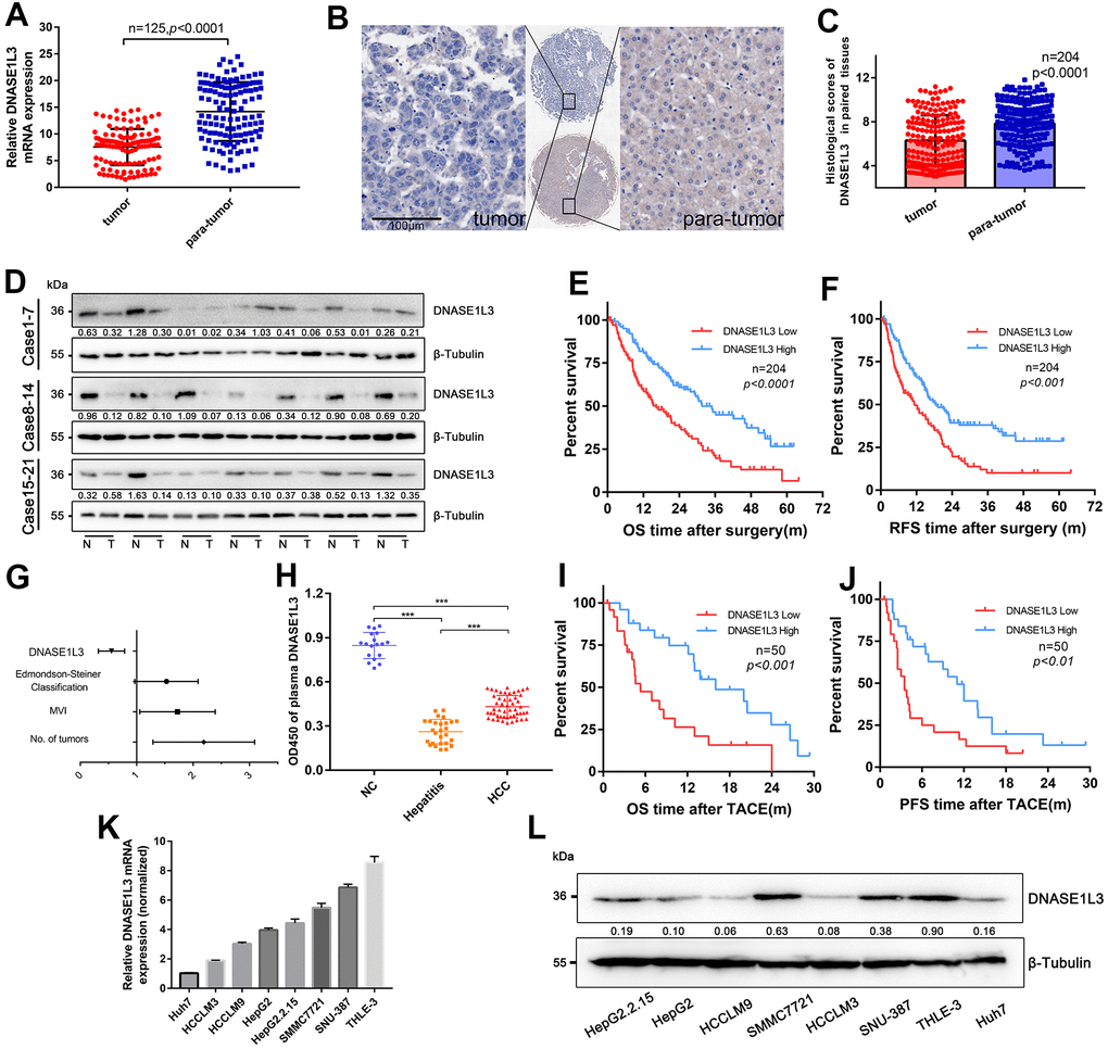 Downregulated DNASE1L3 is positively correlated with prognosis of resectable or unresectable HCC. (A) The transcriptional level of DNASE1L3 was down-regulated in HCC tissues(n=125) compared to paired para-tumor tissues as tested by RT-qPCR. (B) Representative images of IHC staining for DNASE1L3 in HCC and adjacent normal tissues (scale bar, 50 μm). (C) The histological scores of DNASE1L3 in 204 paired tissues of HCC was evaluated. (D) The translational level of DNASE1L3 between HCC tissues and paired adjacent non-tumor tissues from 21 patients were identified by western blotting. (“T” for tumor, “N” for non-tumor). (E, F) Kaplan-Meier survival curves of OS and RFS time for 204 patients with HCC. (G) Forest plot of risk factors of the OS time using multivariate Cox regression analysis. (H) Comparison of plasma levels of DNASE1L3 between patients of HCC(n=50), patients of hepatitis only(n=27) and healthy individuals(n=18). (I, J) Kaplan-Meier survival curves of OS and PFS time for 50 patients with inoperable HCC. (K) RT-qPCR analysis of DNASE1L3 in HCC cell lines and a normal liver cell line (THLE-3). (L) Western blot analysis of DNASE1L3 protein expression in HCC cell lines and a normal liver cell line (THLE-3).