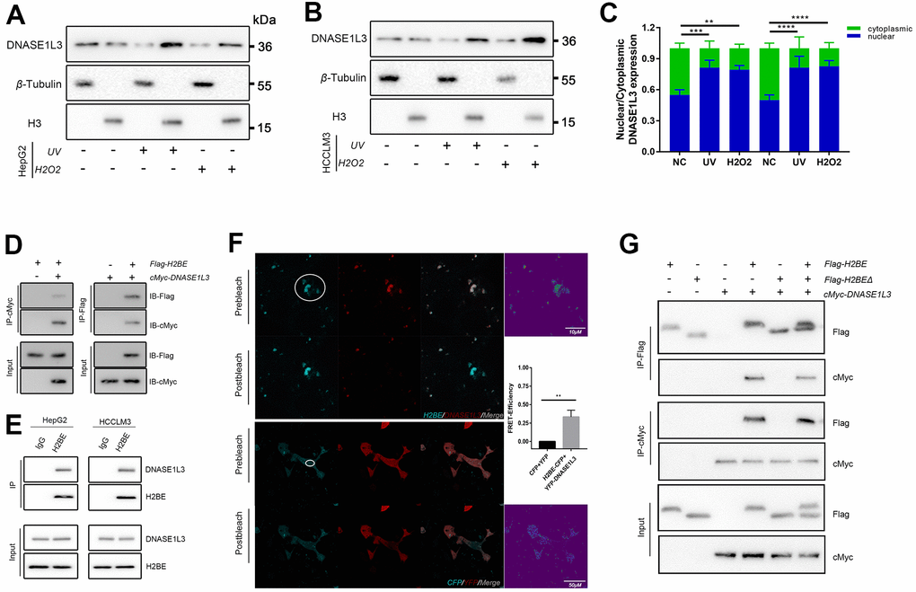 DNASE1L3 interacts with H2BE. (A, B) Immunoblot analysis of DNASE1L3 in the subcellular localization under DNA damage using nucleocytoplasmic separation in two cell lines. (C) The result of blotting confirmed that DNASE1L3 translocated to the nucleus in response to DDR activation. (D) Lysates of 293T cells overexpressing Flag-H2BE and/or cMyc-DNASE1L3 were subjected to reciprocal co-immunoprecipitation (co-IP) to detect protein interaction. (E) HepG2 and HCCLM3 cell lysates were subjected to co-IP and immunoblot to detect endogenous H2BE and DNASE1L3 interaction. (F) FRET assay for DNASE1L3-H2BE interactions in living cells. FRET efficiency were calculated by Leica TCS SP8 software (FRETeff= (Dpost-Dpre)/Dpost). White circles identify FRET area. (G) Co-IP of cMyc-DNASE1L3 and Flag-tagged H2BE or H2BEΔ with N-terminal region (amino acids 1-28) deleted.