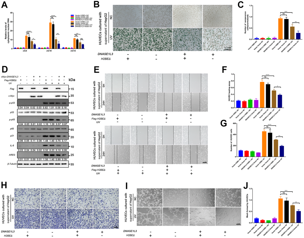 DNASE1L3 impairs angiogenesis by interacting with H2BE. (A) qPCR analysis of chromosomal DNA in the cytoplasmic fraction of differently treated HepG2 cells. (B) Representative images of SA-β-Gal staining of cells in differently treated groups (scale bar, 100 μm). (C) Statistics of SA-β-Gal staining cells in differently treated groups. (D) Immunoblot analysis of inducible expression change of senescence associated signal pathway and downstream proteins including p53, p65, SPINK1 and AREG in differently treated groups. (E, F) The motility of HUVECs were assessed by wound healing assay, the supernatants from cells in different treated groups were added into the culture of HUVECs, images were taken at 0h and 24h (scale bar, 100 μm). (G, H) The cellular migration ability of HUVECs were determined by the transwell migration assay. Cell supernatants from in differently treated groups were added into the lower chamber, images were taken after 24h of incubation (scale bar, 100 μm). (I, J) The tube formation ability of HUVECs were determined by tube formation assay. Cell supernatants from differently treated groups were added into the culture, images were taken after 6h of incubation (scale bar, 100 μm). The results show the means ± SD from at least three separate experiments.