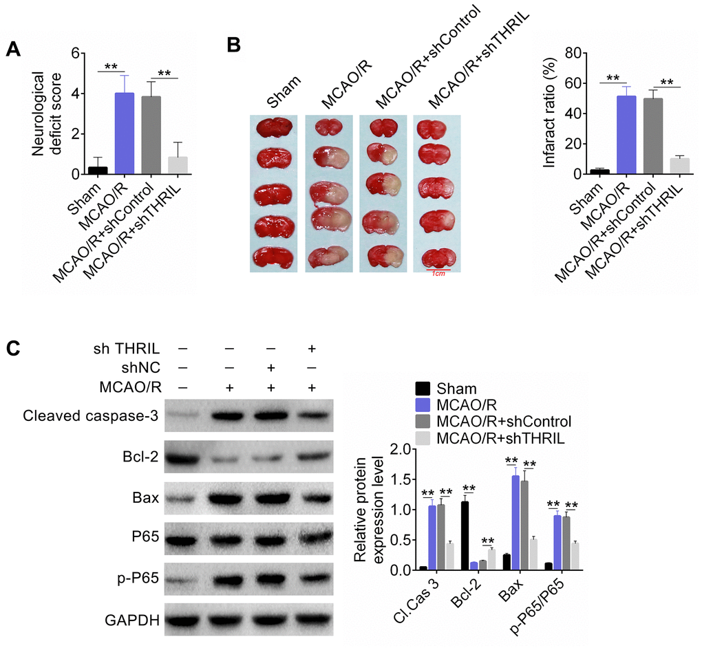 LncRNA THRIL silencing significantly improved the neurological function of the rat MCAO/R model. (A) Nerve injury score of the rat MCAO/R model. (B) Cerebral infarct size was assessed by TTC staining. (C) Western blot detected the apoptosis and p65-associated proteins. Data are shown as mean ± SD for three-independent experiments. **P 