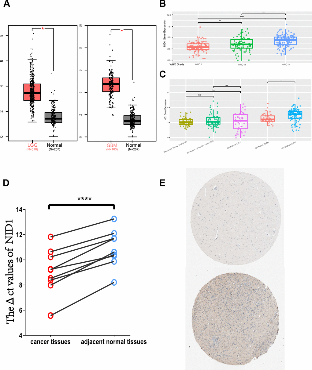 NID1 mRNA and protein expression in different grades of gliomas. (A) NID1 transcript expression levels in low-grade glioma (LGG; red; n=518), glioblastoma multiforme (GBM; red; n=163) and corresponding normal brain tissues (black; n=207) from the GEPIA datasets. (B) NID1 expression levels in different grades of glioma (WHO grades II, III, and IV) from the CCGA dataset. As shown, NID1 expression levels are significantly higher in WHO grades III and IV compared to WHO grade II. (C) NID1 expression levels in LGG and GBM patients belonging to IDH mutant and wild-type genotypes from the CCGA datasets. As shown, IDH mutant GBM patients show lower NID1 levels compared to the IDH wild-type GBM patients. NID1 levels in IDH mutant and wild-type LGG patients are comparable and not statistically significant. (D) NID1 expression is upregulated in all 9 glioma tissue samples compared to their corresponding normal brain tissue samples. Red circles represent glioma tissues and blue circles represent normal brain tissues. Higher ΔCt value represents lower NID1 expression. (E) Representative IHC-stained brain section images from the HPA database show NID1 expression in normal healthy individual (patient i.d. 2521) and glioma patient (patient id: 3092). Blue staining represents anti-NID1 antibody staining. Note: * P