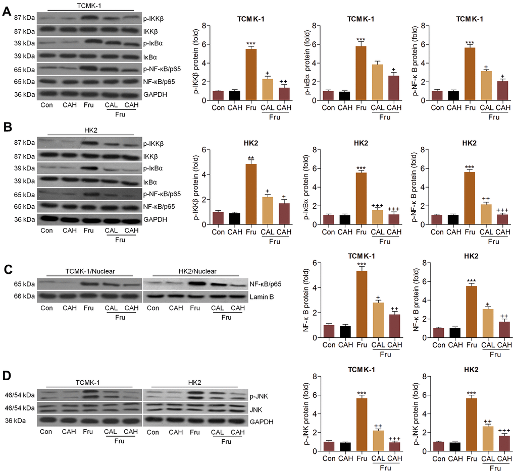 Carminic acid blocks the NF-κB and JNK activation in Fru-treated cells. (A–D) TCMK-1 and HK2 cells were exposed to Fru (5 mM) for 24 h with or without CA (10 and 20 μM). Then, all cells were collected for the subsequent studies. (A, B) Western blotting analysis for p-IKKβ, p-IκBα and p-NF-κB in TCMK-1 and HK2 cells. (C) The protein expression levels of NF-κB were measured in nuclear of cells by western blot analysis. (D) Western blot analysis was used to determine p-JNK protein expression levels in cells. The results are expressed as the means ± SEM. n = 4 in each group. ***P+P++P+++P