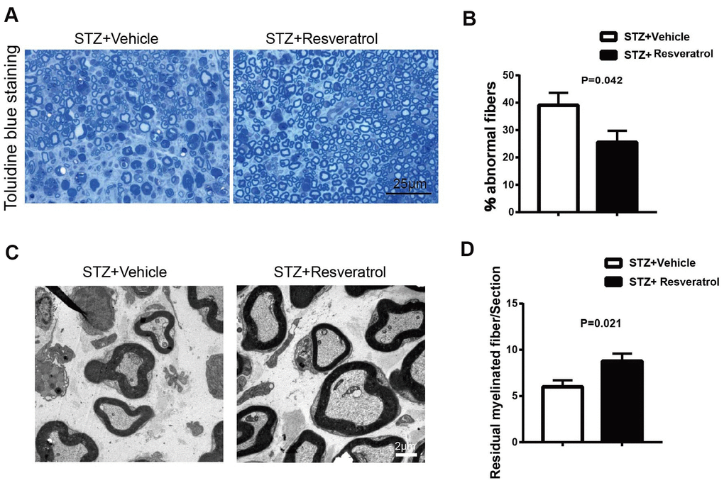 (A, B) Toluidine blue staining of semi-thin transverse sections of STZ+Vehicle and STZ+Resveratrol mice at 12 weeks after STZ injection. The percentage of abnormal fibers was quantitated (n = 3 mice per group; data are presented as means ± SEM). (C, D) Morphological assessment of axonal and myelin in sciatic nerves from STZ+Vehicle and STZ+Resveratrol mice. Representative electron micrographs from transverse ultra-thin sections of the sciatic nerves from STZ+Vehicle and STZ+Resveratrol at 12 weeks after STZ injection. (n = 3 nerves for each group, data are represented as the mean ± SEM).
