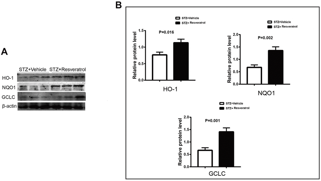 (A, B) Western blot analyses of lysates of HO-1, NQO1, GCLC from STZ+Vehicle and STZ+Resveratrol mice using the indicated antibodies at 12 weeks after STZ injection (n = 3 nerves for each group, data are represented as the mean ± SEM).