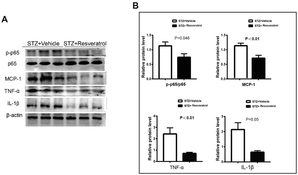 (A, B) Western blot analysis of lysates of p-p65/p65, MCP-1, TNF-a, IL-1β from STZ+Vehicle and STZ+Resveratrol mice, Quantification by Western blot analysis showed that the activation of AKT and the Bax, Cleaved caspase3 decreased in STZ+Resveratrol mice at 12 weeks after STZ injection (n = 3 nerves for each group, data are represented as the mean ± SEM.).