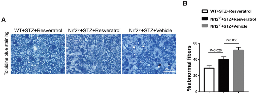 (A, B) Toluidine blue staining of semi-thin transverse sections of Nrf2-/-+STZ+Resveratrol, Nrf2-/-+STZ+Vehicle and WT+STZ+Resveratrol mice at 12 weeks after STZ injection, The percentage of abnormal fibers was quantitated, and the difference between the three groups was significant (n = 3 mice per group; data are presented as means ± SEM).
