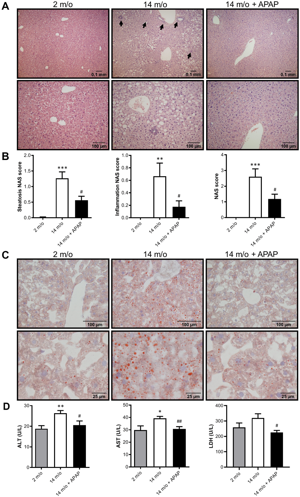 Chronic APAP exposure ameliorates the effect of age in liver alterations. (A, C) Representative images (10X and 20X) of H&E (A) and Oil Red O (C) staining performed on various sections of livers from 2 m/o, 14 m/o and 14 m/o + APAP mice. (B) Steatosis NAS score, inflammation NAS score, and total NAS score. (D) Plasma ALT, AST and LDH levels from 2 m/o, 14 m/o and 14 m/o + APAP mice. Values are expressed in international units per liter (U/L). Data are represented as the mean ± S.E.M. (n = 6-18 mice per group). Statistical analysis was performed by one-way ANOVA or Brown-Forsythe and Welch ANOVA test followed by their respective post-hoc test. * P P P vs. 2 m/o; #P ##P vs. 14 m/o.