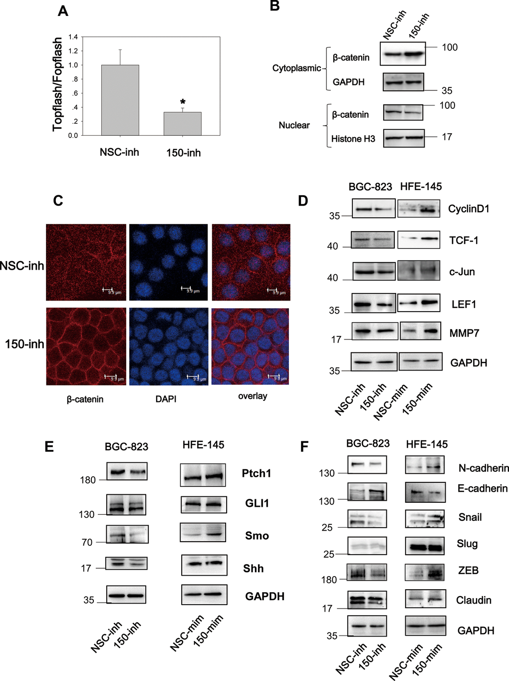 MiRNA-150 triggers the activation of the Wnt and Hh signaling pathways. (A) MiRNA-150 activated TOPFlash/FOPFlash luciferase activity. A TOPFlash/FOPFlash assay was conducted in BGC-823 cells transfected with miRNA-150 inhibitors. (B) The expression of β-catenin in the cytoplasm and nuclei of BGC-823 cells transfected with miRNA-150 inhibitors is shown. (C) Immunofluorescence analysis of the localization of β-catenin in BGC-823 cells transfected with miRNA-150 inhibitors is shown. (D, E) MiRNA-150 activated Wnt and Hh target gene expression. The expression of Wnt and Hh downstream target genes in BGC-823 and HFE-145 cells was detected by western blotting. (F) MiRNA-150 induced EMT. The expression of EMT markers in BGC-823 cells or HFE-145 cells was measured by western blotting.