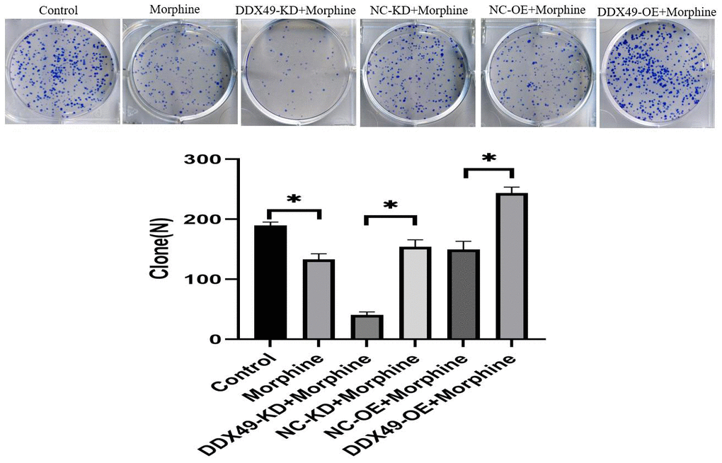 Effect of DDX49 on cell clone formation after HCC cells treat with morphine. Cell colony formation after DDX49 depletion/overexpression treat with morphine(10μM). Morphine QGY-7703 cells were treated with morphine (10μM) for 48h. *P 