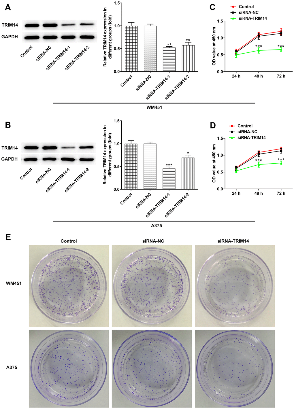 Knockdown of TRIM14 inhibited melanoma cell proliferation. Both WM451 and A375 cells were transfected with siRNA-NC and siRNA-TRIM14-1/2, then the protein expression of TRIM14 in each group was measured using western blot (A–B). After transfection, the cell proliferation was determined using CCK-8 assay (C–D) and clone formation assay (E). *, **, ***p 