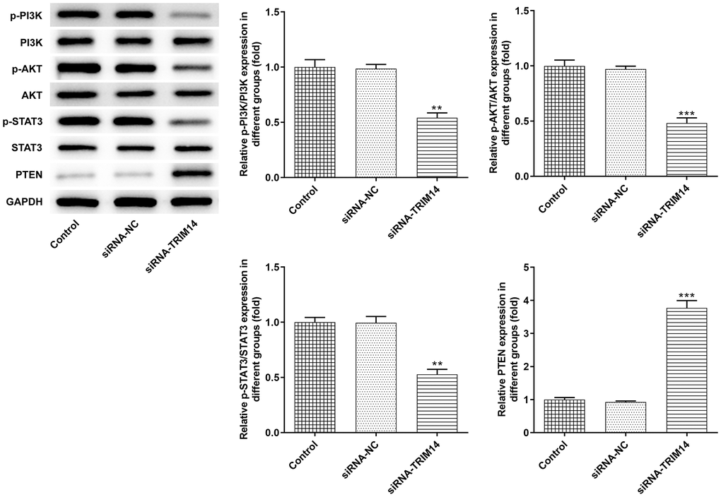 Knockdown of TRIM14 inactivated AKT and STAT3 pathways. A375 cells were transfected with siRNA-NC and siRNA-TRIM14, respectively. The protein expression of PTEN, p-PI3K/PI3K, p-AKT/AKT, p-STAT3/STAT3 was detected using western blot. **, ***p 