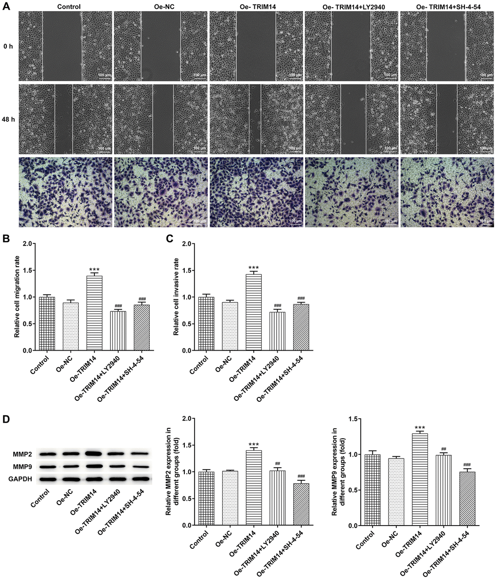 TRIM14 overexpression enhanced melanoma cell migration and invasion through AKT and STAT3 pathways. After indicated treatment, the migration and invasion abilities of A375 cells were determined using wound-healing assay and Transwell assay, respectively (A–C). The protein expression of MMP2 and MMP9 was determined using western blot (D). Magnification ×100. ***p ##, ###p 