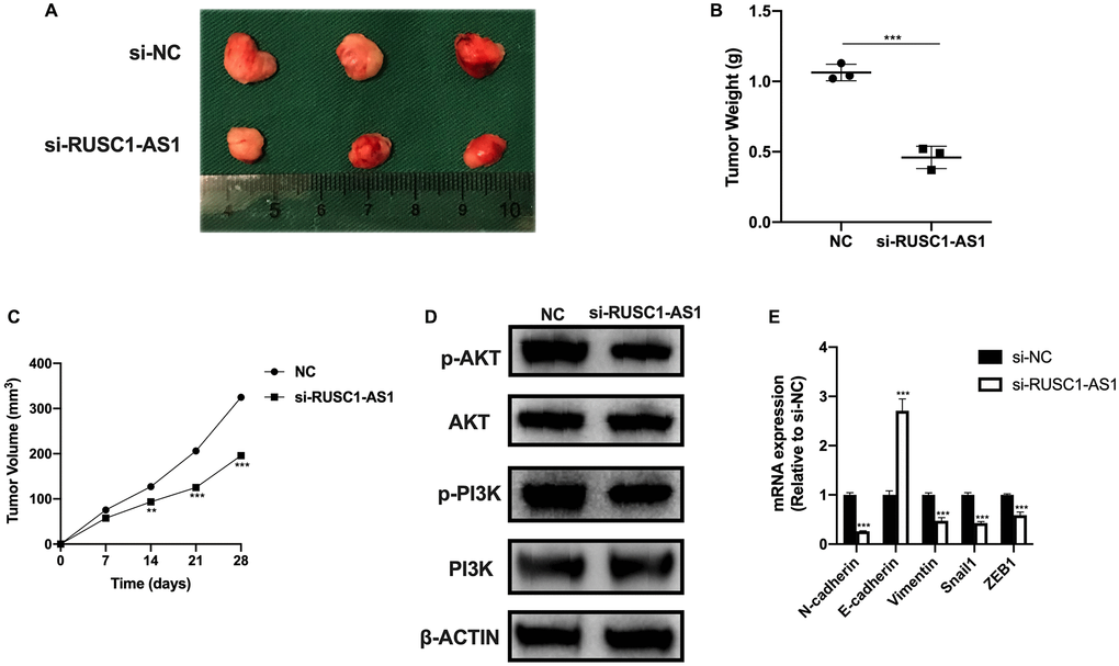 RUSC1-AS1 promoted osteosarcoma cell growth in vivo. (A) Tumor growth, (B) tumor weight and (C) tumor volume in U2OS injected nude mice treated with si-NC and si-RUSC1-AS1. (D) The protein expression of p-AKT, AKT, p-PI3K and PI3K in tumor cells from si-NC or si-RUSC1-AS1 treated mice. (E) The expression of EMT-related genes in mice treated with si-NC and si-RUSC1-AS1.