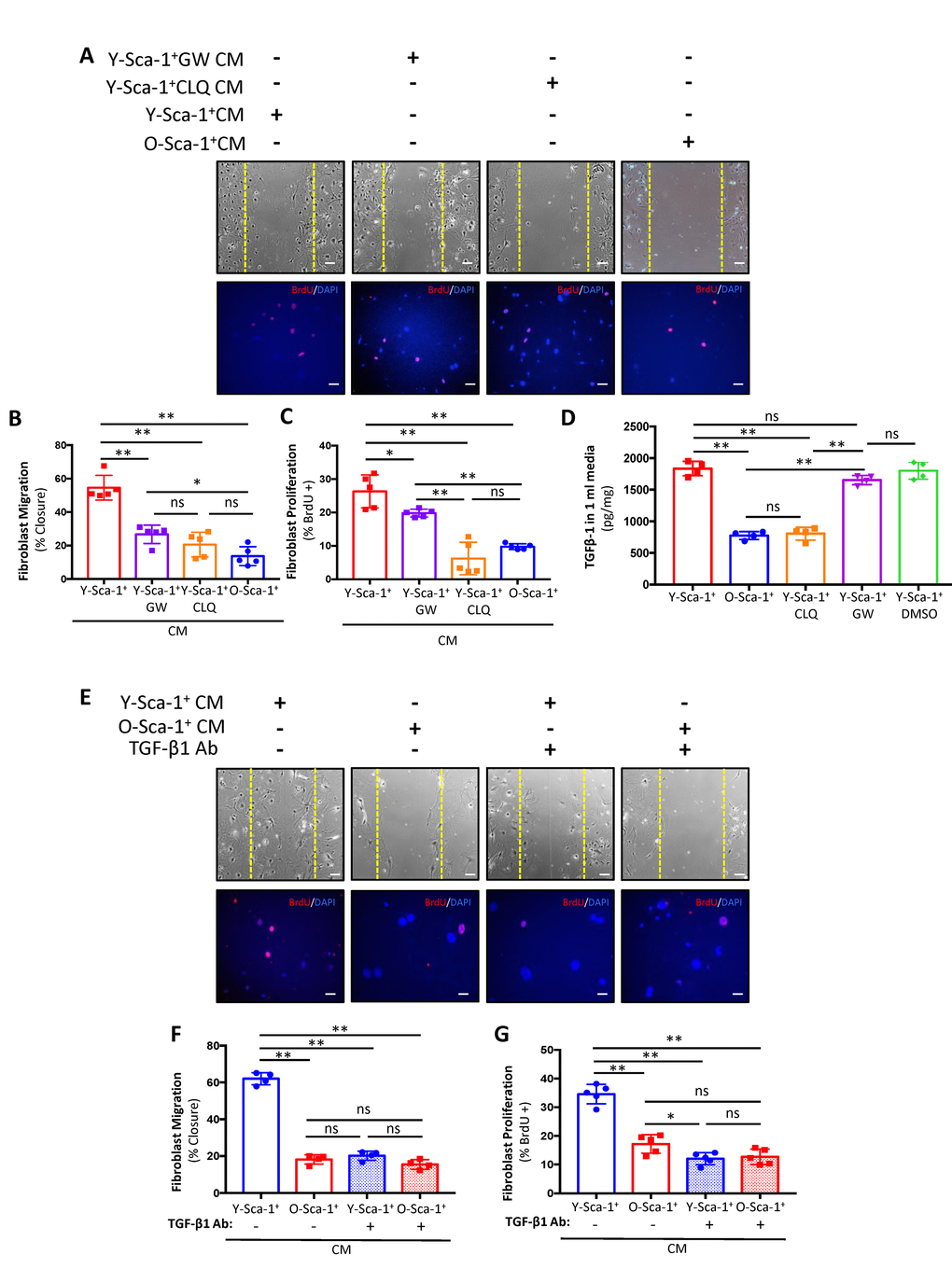 Y-Sca-1+ BMCs enhance old cardiac fibroblast function via autophagy-dependent TGF-β1 secretion. (A) Y-Sca-1+ bone marrow cells (BMCs) were treated with pharmacological inhibitors of autophagy (chloroquine, CLQ) and extracellular vesicle (EV) secretion (via GW4869). Conditioned medium (CM) was then collected and added to cultured cardiac fibroblasts isolated from old mice. Treatments are abbreviated as: Y-Sca-1+ CM±CLQ, Y-Sca-1+ CM±GW4869 or O-Sca-1+ CM. Representative images from scratch wound and proliferation assays after old cardiac fibroblasts were treated with CM from Y-Sca-1+ CM±CLQ, ±GW4869 and O-Sca-1+ CM for 48, or 24 hours, respectively. (B) Percent wound closure (after completing the scratch wound assay) was measured using ImageJ. Dashed yellow line indicates the wound edge at 0 hours. (C) Percentage of BrdU+ cells, normalized to total cell number. (D) TGF-β1 levels were measured in CM using ELISA. (E) Representative images from scratch wound and proliferation assays after old fibroblasts were treated with CM in the presence of TGF-β1 blocking antibody (Ab) for 48 hours. Treatment groups are abbreviated as: Y-Sca-1+ CM± TGF-β1 Ab and O-Sca-1+ CM± TGF-β1 Ab. Dashed yellow line indicates the wound edge at 0 hours. (F) Percent wound closure (after completing the scratch wound assay) was measured using ImageJ. (G) Percentage of BrdU+ cells, normalized to total cell number. Scale bars represent 100 μm. One-way ANOVA used to analyze data. n=3-4 *p≤0.05; **p≤0.01; ns: not statistically significant.