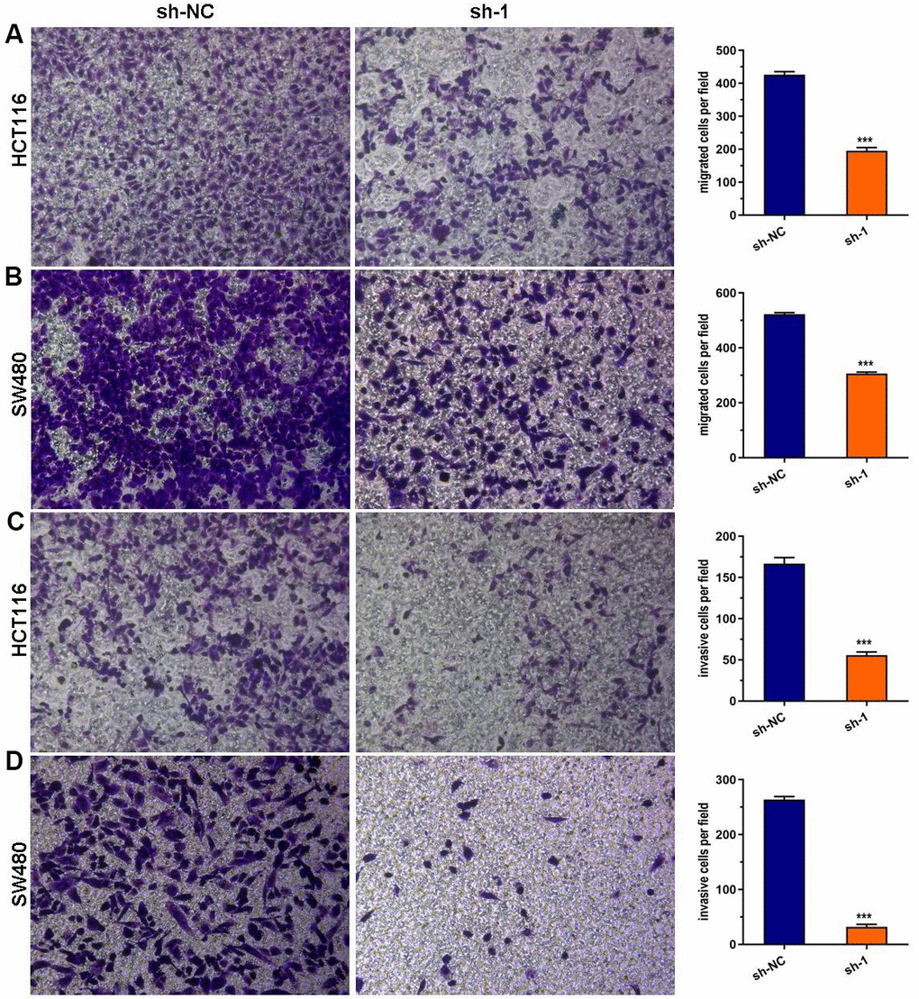 ABHD11-AS1 deficiency suppressed CRC cell migration and invasion. (A) Transwell assay for cell migration. The ABHD11-AS1-deficiency HCT116 cell had significantly less migration cells than that of control. (B) Transwell assay for cell migration. The ABHD11-AS1-deficiency SW480 cell had significantly less migration cells than that of control. (C) Transwell assay for cell invasion. The ABHD11-AS1-deficiency HCT116 cell had significantly less invasion cells than that of control. (D) Transwell assay for cell invasion. The ABHD11-AS1-deficiency SW480 cell had significantly less invasion cells than that of control. ***P