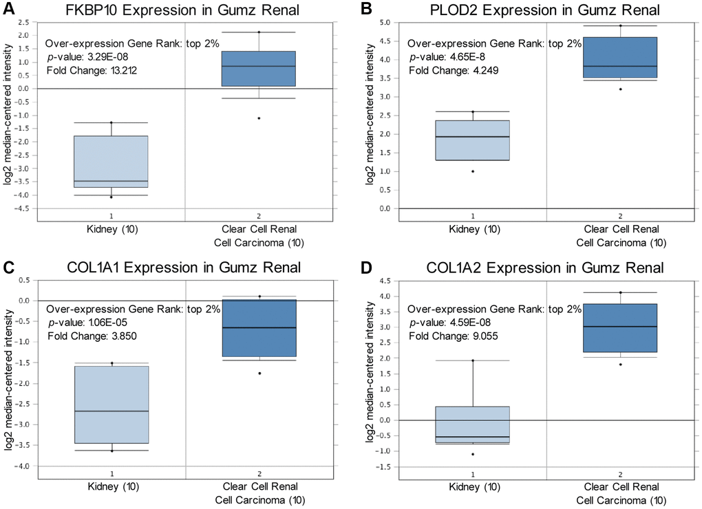 FKBP10, PLOD2 and pro-collagen I shows high transcription level in ccRCC. Levels of FKBP10, PLOD2 and pro-collagen I mRNA were significantly higher in ccRCC than in normal tissue. Fold change, associated p values, and overexpression gene rank are shown. (A) FKBP10 mRNA expression level in Gumz Renal dataset. FKBP10 presented a fold change of 13.212, ranking top 2% in overexpression gene. (B) PLOD2 mRNA expression level in Gumz Renal dataset. PLOD2 presented a fold change of 4.249, ranking top 2% in overexpression gene. (C), (D) COL1A1 and COL1A2 mRNA expression level in Gumz Renal dataset. COL1A1 and COL1A2 presented a fold change of 3.850 and 9.055 respectively, both ranking top 2% in overexpression gene.