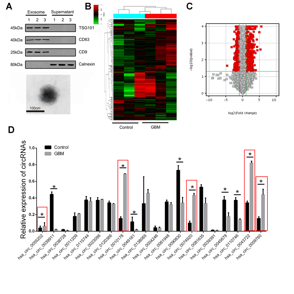 The expression landscape of circulating exosome-derived circRNAs in GBM patients. (A) Western blot was used to detect the expression of CD9, CD63, TSG101 and calnexin in exosome isolated from plasma samples of GBM patients (upper panel). Plasma exosomes were observed using TEM (lower panel). (B) Cluster analysis of the different expression of the circRNAs in different groups. (C) Volcano plot presented the dysregulated circRNAs in GBM comparing with control group. Red plots indicated with significant difference. (D) The expression of circRNAs were confirmed by RT-PCR in training set. * indicated P