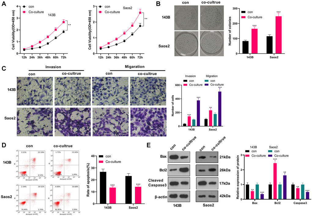 M2-TAM exosomes strengthened OS growth and metastasis. Il-4/13-induced M2-TAMs were co-cultured with 143B and Saos2 cells. (A) CCK-8 tested cell viability. (B) CCK-8 assayed cell proliferation. (C) Cell migration and invasion were examined by Transwell assay. (D) Cell apoptosis was determined by FCM. (E) The profiles of Bax, Bcl2 and Cleaved Caspase-3 were compared by WB. *P **P ***P N = 3.