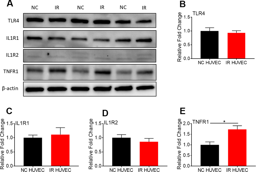 Comparison of the expression of surface receptors of inflammatory stimulants in NC HUVEC and IR HUVEC. Representative western-blot images (A) and densitometry based quantitative analysis of TLR4 (B) IL1R1 (C), IL1R2 (D), and TNFR1 (E) in NC HUVEC and IR HUVEC. β-actin was used as a loading control. (n = 3; mean ± SEM; * p