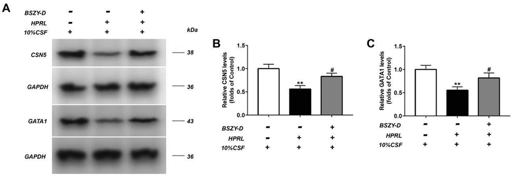 The levels of CSN5 and GATA1 in GT1-7 were detected by western blot assay, and representative bands were shown in (A). The levels of CSN5 (B) and GATA1 (C) were normalized to control. The results were presented as mean ± SD (n = 3).**p 