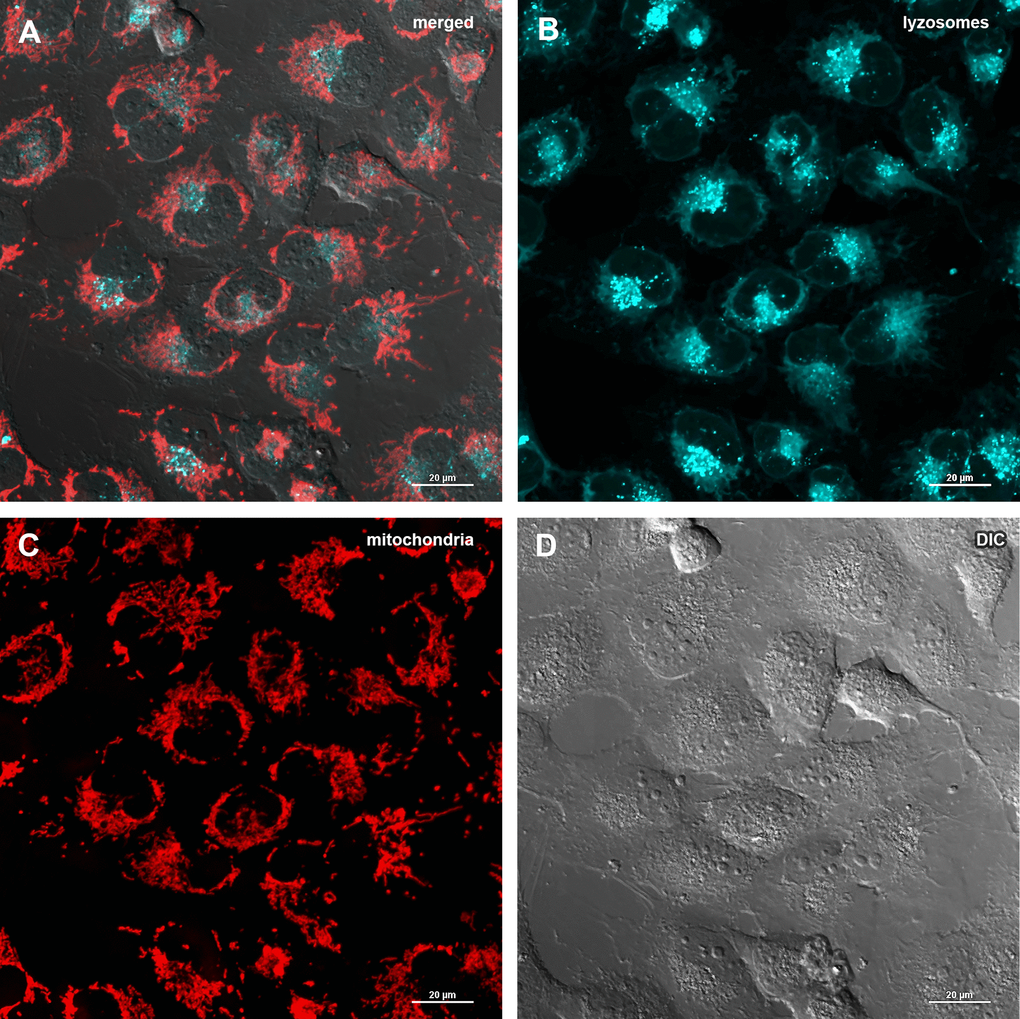 Assessment of mitophagy in MRC5-SV40 cells when treated with DMSO 0.5% for 24 hours. (A) merge of red, green fluorescence channels and bright field, (B) green fluorescence channel, (C) red fluorescence channel, (D) bright field.