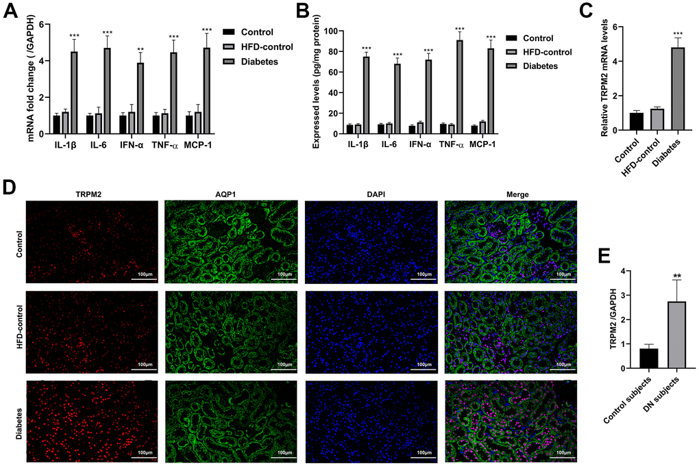 Inflammatory response and the localization of TRPM2 in the kidneys of mice with HFD/STZ-induced diabetes. (A) qRT-qPCR assay was used to determine the mRNA expression of inflammatory factors including IL-1β, IL-6, IFN-α, TNF-α and MCP-1 in the kidney tissues of mice in the 24th week. (B) ELISA was used to determine the contents of inflammatory factors including IL-1β, IL-6, IFN-α, TNF-α and MCP-1 in the kidney tissues of mice in the 24th week. (C) qRT-PCR assay was performed to assess the mRNA levels of TRPM2 in the kidney tissues of mice in the 24th week. (D) IF double-staining analyses of TRPM2 and APQ1 in the renal tissues of mice in the 24th week. (E) qRT-PCR assay was performed to assess the mRNA levels of TRPM2 in kidney biopsies obtained from human subjects with diabetic nephropathy. The data are shown as the mean ± SD, n = 6 per group; *p 