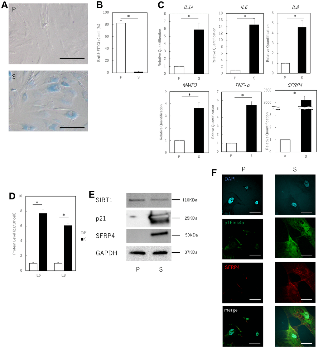 Aging human skin fibroblasts express SFRP4. (A) SA-β-gal staining of proliferating and senescent cells. Senescent cells profusely express SA-β-gal in the cytoplasm. Bar = 50 μm. (B) BrdU absorption by proliferating and senescent cells. Senescent cells have decreased BrdU absorption due to decreased mitotic activity. (C) RT-PCR analysis of SASP gene expression by cell extracts. GAPDH was used as the housekeeping gene. (D) ELISA for protein expression of IL6 and IL8. (E) Western blot analysis of cell extract proteins. GAPDH was used as the housekeeping protein. (F) Immunostaining of p16ink4a and SFRP4 in proliferating and senescent cells. SFRP4 expression is observed in the cytoplasm in senescent cells consistent with p16ink4a positivity. Bar = 20 μm. P: Proliferating cells. S: Senescent cells. *; P 