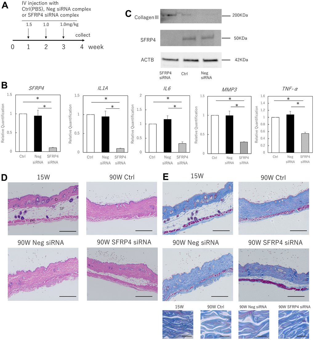 Effects of SFRP4 knockdown on the skin of aging mice. (A) Time course of the experiment. (B) RT-PCR analysis of SFRP4 and SASP gene expression in total skin extract. (C) Western blot analysis of collagen III and SFRP4 expression in whole skin extracts. SFRP4 siRNA treatment suppressed the expression of SASP factors and aging-related proteins, and increased collagen III. (D) H-E staining of skin from young (15 weeks old), control (PBS) aged, negative siRNA, and SFRP4 siRNA mice; thinning of subcutaneous adipose tissue and panniculus carnosus was observed in the control aged and negative siRNA groups. SFRP4 siRNA treatment improved these phenotypes. SF: Subcutaneous fat tissue; PC: Panniculus carnosus. Bar = 100 μm. (E) Skin in each intervention mouse; Masson’s trichrome staining; reduced thickness and density of collagen fibers and dermal connective tissue were observed in control aged mice and negative siRNA-treated mice, but the same improved with SFRP4 siRNA treatment. Collagen fibers are shown at higher magnification in the lower panel. Bar = 100 μm in the overall view, bar: 5 μm in magnified view. *; P 