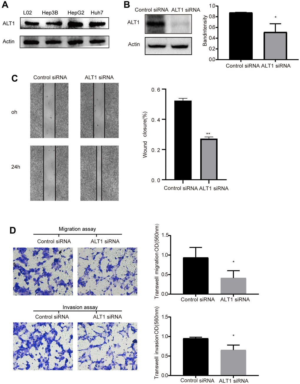 (A) Western blot analysis of ALT1expression in L02, Hep3B, HepG2, and Huh7 cells. (B) Quantitative analysis results and representative images of the Western blot results for ALT1. (C) The migration ability of cells in the wound healing assays following ALT1 silencing (10× magnification). (D) The migration and invasion ability of cells in the transwell assays following ALT1 silencing.