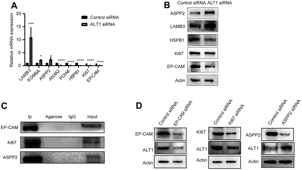 (A) RT-qPCR measured the relative mRNA expression levels of LAMB3, KDM6A, ASPP2, ANXA2, PDIA6, HSPB1, KI67, and EP-CAM. (B) A representative Western blot analysis for ASPP2, LAMB3, HSPB1, KI67, and EP-CAM expression in HepG2 cells. (C) A representative Western blot analysis for EP-CAM, KI67, and ASPP2 co-immunoprecipitation with ALT1 used as a bait protein. (D) A representative Western blot analysis for ALT1 expression in EP-CAM, KI67, and ASPP2 knockdown HepG2 cells.