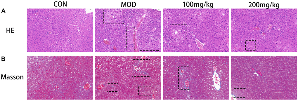 (A) Histological micrograph of sof hematoxylin-eosin staining liver sections. (B) Histological micrograph of a liver section stained by Masson.