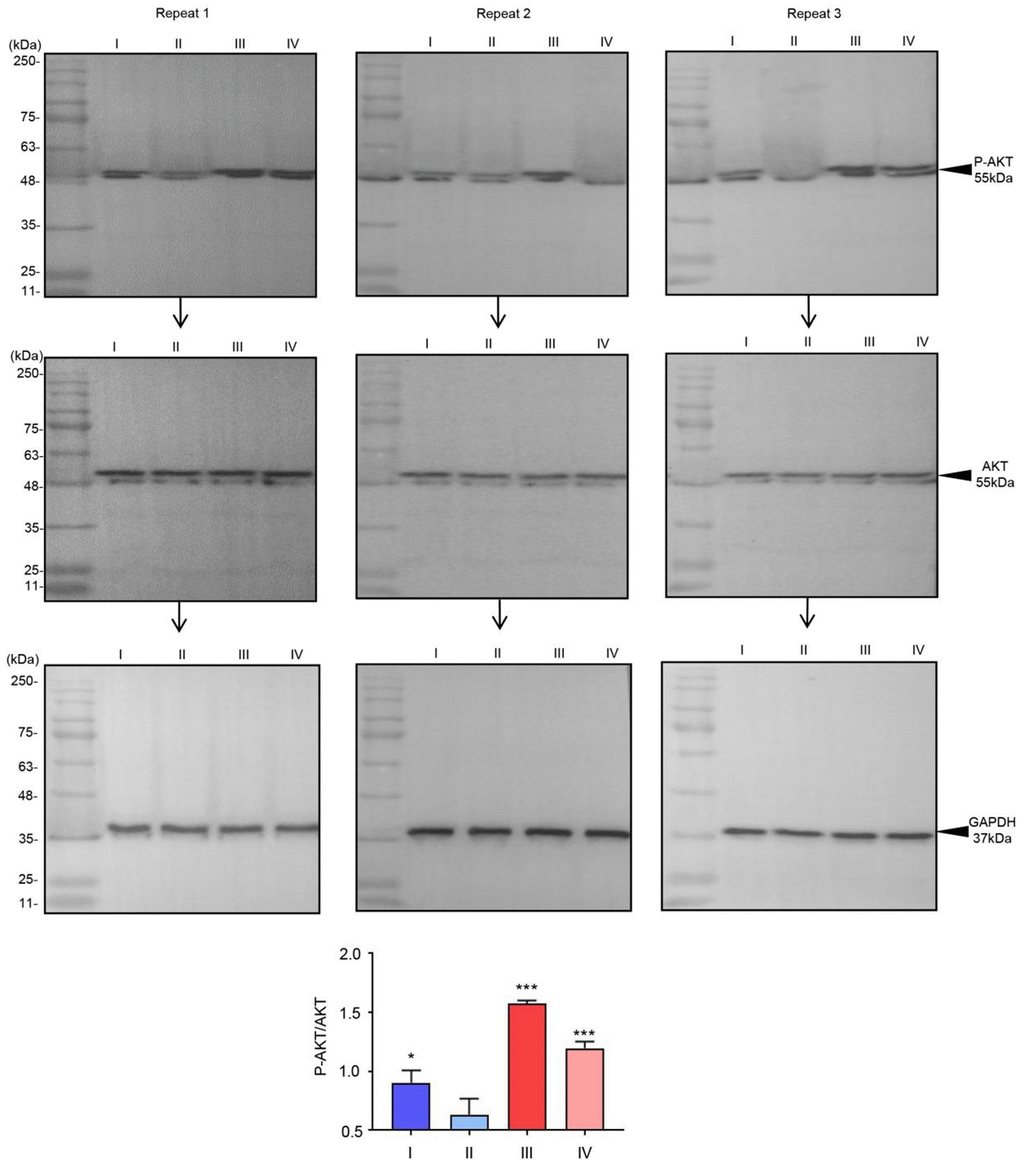 The phosphorylation of AKT in urine sample. Phosphorylation of AKT in urine sample regulated by radiotherapy. The relative intensity of P-AKT was compared with AKT.*p***p