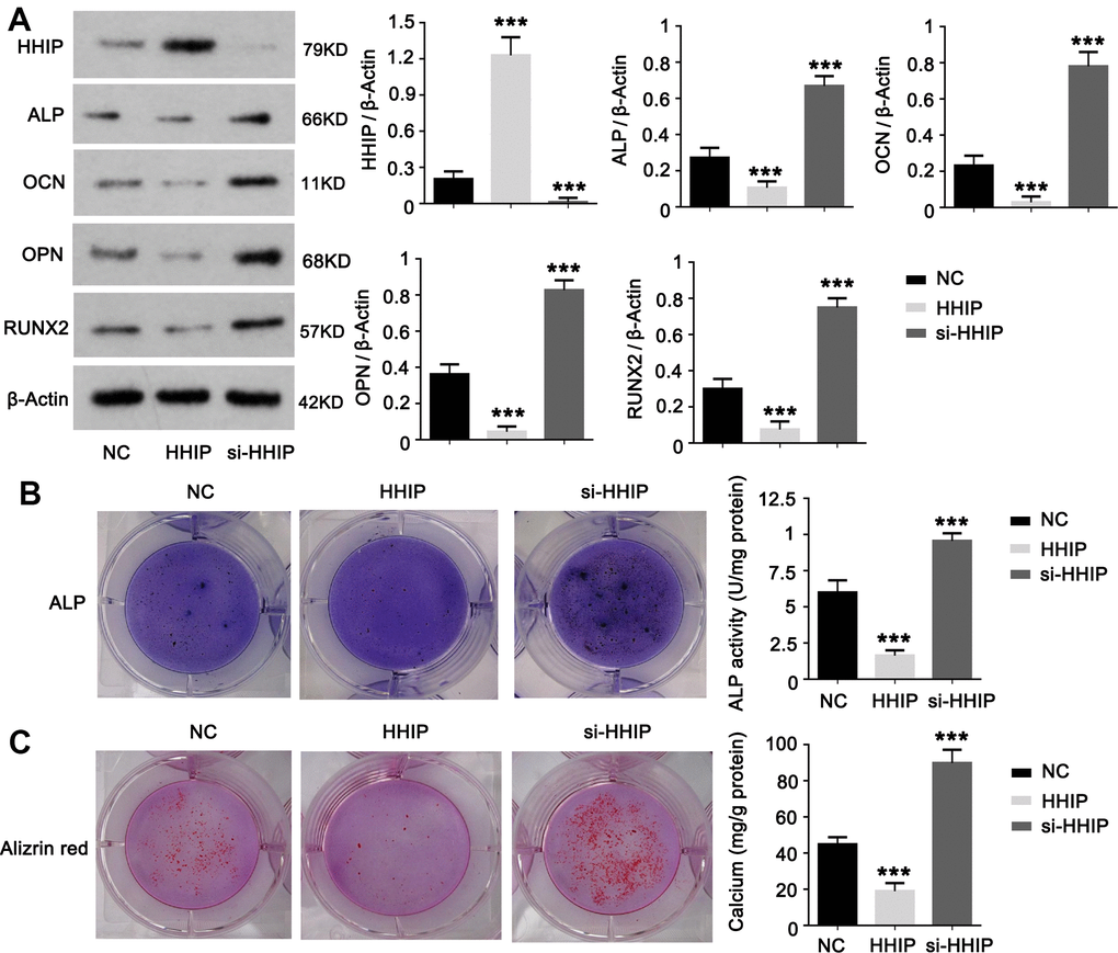 HHIP protein inhibits osteogenic differentiation of BM-MSCs. (A) We constructed HHIP-silenced (si-HHIP) and HHIP-overexpressed (HHIP) BM-MSCs. RUNX2, OCN, ALP and OPN protein levels were detected after 14 days of osteogenic induction of the BM-MSCs. (B) ALP and (C) alizarin red staining after 14 days of osteogenic induction of BM-MSCs. *P P P 