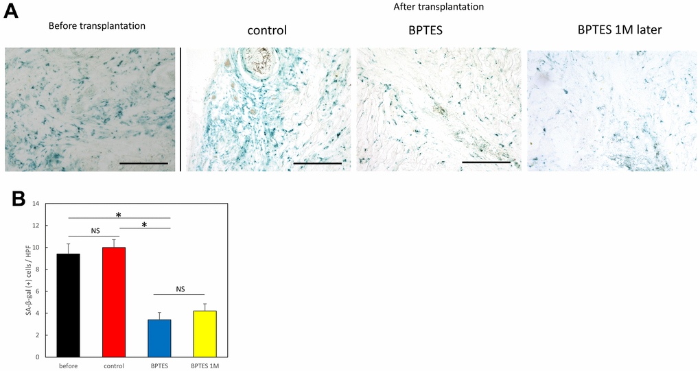 Removal of SA-β-Gal-positive cells from human skin grafts by BPTES treatment. (A) Skin tissue stained with SA-β-Gal (blue); Bar = 100 μm. (B) Quantification of SA-β-Gal-positive cells in the dermis, excluding the area of the skin appendage. The number of positive cells was counted in high magnification field of view (HPF) (≥5 fields of view per sample). Graphs show the mean ± SEM of three independent experiments. *p 