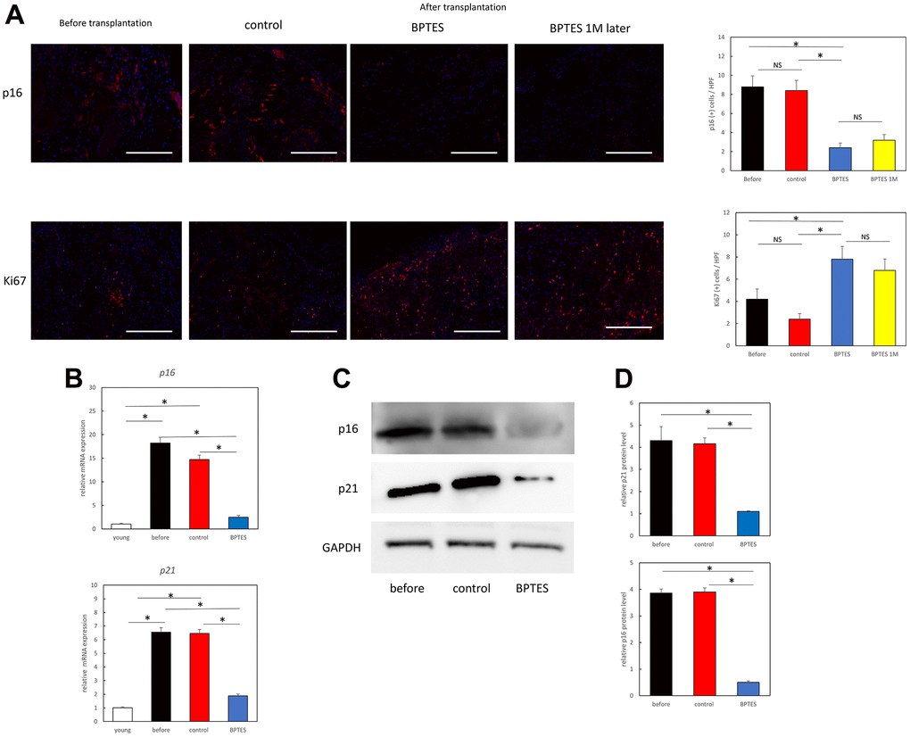 BPTES treatment promotes the removal of skin senescent cells and cell proliferation from human skin grafts. (A) Immunofluorescence staining for p16 or Ki67 in tissue sections of human skin grafts from pre-transplanted aged human skin, treated with control (DMSO) or BPTES. Red: p16, Ki67; Blue: DAPI. The percentage of p16- or Ki67-positive dermal cells at a depth of 100 μm from the epidermal basement layer was counted with DAPI. All results are expressed as mean ± SEM. *p B) Relative p16 and p21 mRNA levels were analyzed using RT-qPCR in skin sections of the indicated mice. *p C) Western blot analysis of p16 and p21. (D) Quantitative analysis of western blot. Band densities normalized against endogenous control GAPDH are shown. *p 