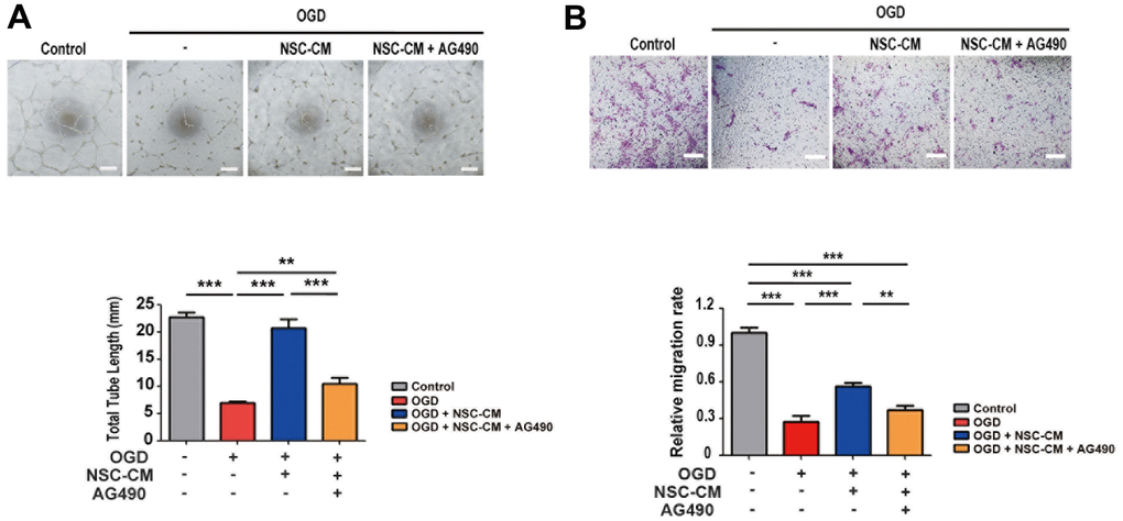 Roles of JAK2/STAT3 signaling pathway in pro-angiogenic effects of ahNSCs. (A) HUVECs were challenged by OGD for 1 h and then incubated in IM, NSC-CM, or NSC-CM with AG490 (50 μM) for 24 h. After 24 h, the total tube length was measured and compared (n = 3 per group). Scale bar = 100 μm. Mean ± SD. ** P P B) HUVECs challenged by OGD for 1 h were cultured in IM, NSC-CM, or NSC-CM with AG490 (50 μM) for 24 h and allowed to migrate through. After 24 h, relative ratio of migrated HUVECs was measured and compared. Scale bar = 100 μm. Mean ± SD. **P P 