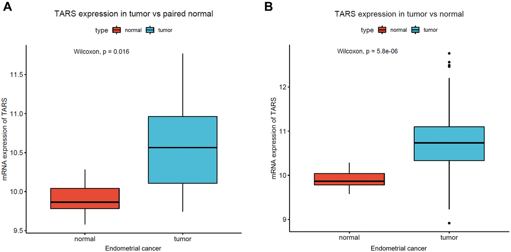 High TARS expression in endometrial cancer. (A) TARS expression in tumor vs. paired normal tissue. (B) TARS expression in tumor vs. normal tissue.