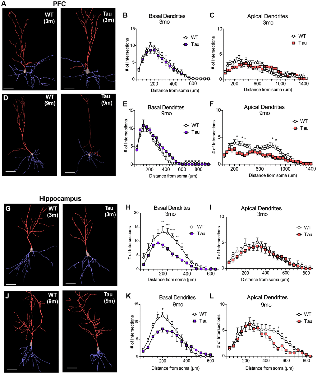 Golgi staining revealed morphological changes in pyramidal neurons of PFC and hippocampus from P301S Tau mice at different ages. (A, D, G, J) Representative reconstructed images of layer V pyramidal neurons in PFC (A, D) or CA1 hippocampus (G, J) from WT and P301S mice at 3 months (A, G) and 9 months (D, J). Basal dendrites are traced in blue, while apical dendrites are traced in red. Scale = 100 μm. (B, C, E, F) Plots of dendritic branching as measured by Sholl analysis of basal dendrites and apical dendrites of layer V PFC pyramidal neurons from WT and P301S mice at 3 months (B, C, n = 10 neurons/group) and 9 months (E, F, n = 11 neurons/group). (H, I, K, L) Plots of dendritic branching as measured by Sholl analysis of basal dendrites and apical dendrites of CA1 pyramidal neurons from WT and P301S mice at 3 months (H, I, n = 10 neurons/group) and 9 months (K, L, n = 10 neurons/group). *p **p ***p ****p 