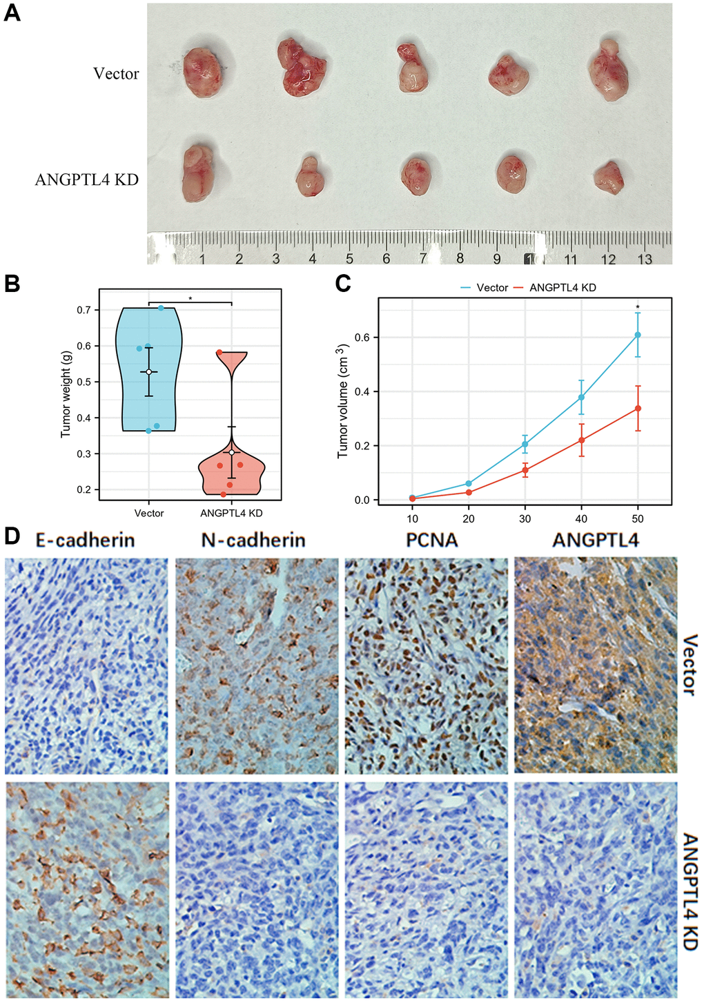 The effect of ANGPTL4 on LUAD cell growth in vivo. (A) The effects of ANGPTL4 shRNA lentivirus plasmid transfection or empty vector lentivirus plasmid transfection on A549 growth in vivo. The tumor weight (B) and volume (C) of the xenografts in ANGPTL4 KD group and vector group. (D) IHC staining for E-cadherin, N-cadherin, PCNA and ANGPTL4 in these xenografts for confirming the effects of ANGPTL4 on LUAD EMT cascade and proliferation. *P 