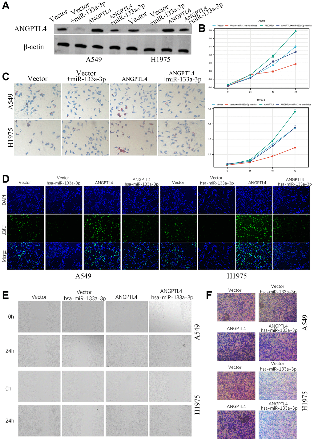 The role of miR-133a-3p/ANGPTL4 axis in LUAD cell proliferation and invasion. (A) The ANGPTL4 protein expression was confirmed by Western blot. (B) The effect of miR-133a-3p/ANGPTL4 axis on LUAD cell proliferation by MTT. (C) The effect of ANGPTL4 KD on lipids metabolism by oil red O. (D) LUAD proliferation ability for miR-133a-3p/ANGPTL4 axis was showed by EdU analysis. The effect of miR-133a-3p/ANGPTL4 axis on LUAD cell migration by wound healing (E) and invasion by Transwell analysis (F).