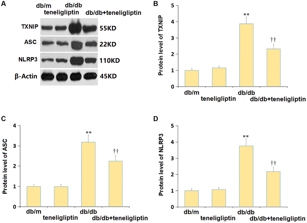 Teneligliptin inhibited the NLRP3 inflammasome in the hippocampus of db/db mice. (A) Protein level of genes were determined using western blots; (B) Protein level of TXNIP; (C) Protein level of ASC; (D) Protein level of NLRP3 (**P ††0.01 vs. Teneligliptin group).