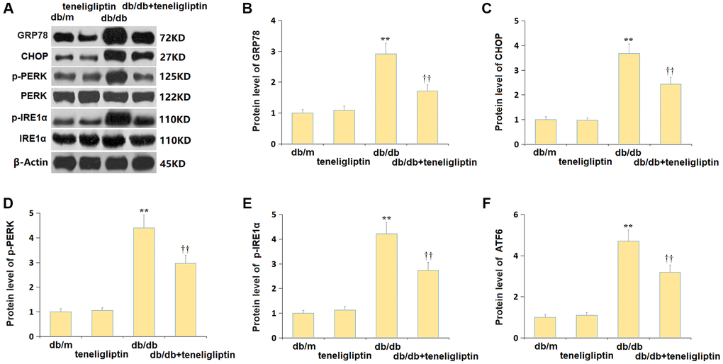 Teneligliptin alleviated the ER stress in the hippocampus of db/db mice. (A) Protein level of genes were detected by western blots; (B) Protein level of GRP78; (C) Protein level of CHOP; (D) Protein level of p-PERK; (E) Protein level of p-IRE1α; (F) Protein level of ATF6 (*, **P †, ††P 