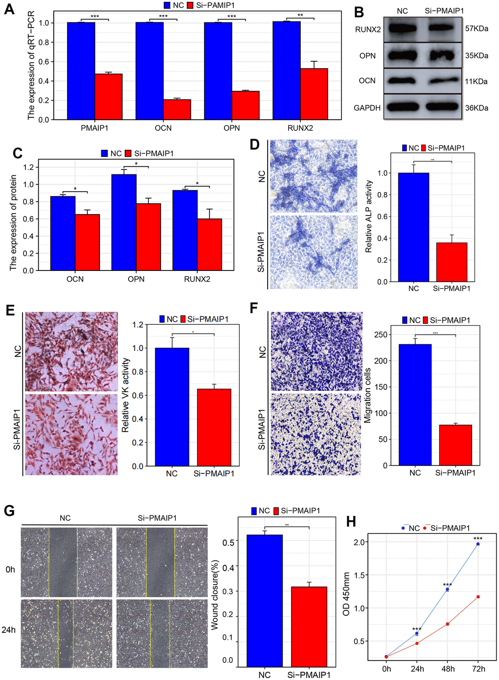 Validation of the influence of PMAIP1 on osteogenesis, migration, and cell growth of BMSCs. (A) RT-qPCR (B, C) Western blotting (D) ALP staining (E) VK staining (F) Transwell assay of migration (G) Wound healing assay (H) CCK-8 assay.
