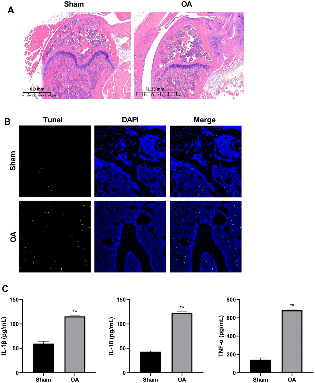 Construction of osteoarthritis mice model. (A) Cartilage HE staining results of OA model and controls. (B) Apoptosis of chondrocytes was detected by TUNEL immunofluorescence. (C) ELISA was used to detect the expression of IL-1β, IL-18, and TNF-α in the serum of mice models and controls. (**P 