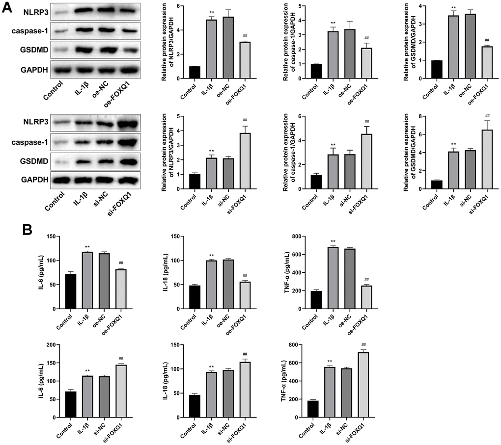 FOXQ1 affects pyroptosis. (A) Western blot result of NLRP3, caspase-1, and GSDMD. (B) ELISA results of IL-6, IL-18, and TNF-α in serum. (**P ##P 