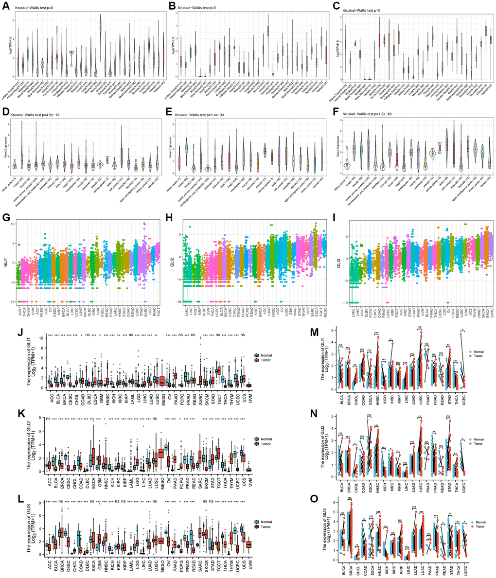 Expression profiles of GLI1, GLI2, and GLI3. Expression levels of GLI1, GLI2, and GLI3 in normal tissues (A–C), tumor cell lines (D–F), and tumor tissues (G–I) using data from the GTEx database. Combined TCGA and GTEx data of GLI1 (J), GLI2 (K), and GLI3 (L) expression differences between tumor and normal tissues (*p **p ***p M), GLI2 (N), and GLI3 (O) between paired tumors and normal tissues using data from the TGGA database (*p **p ***p 