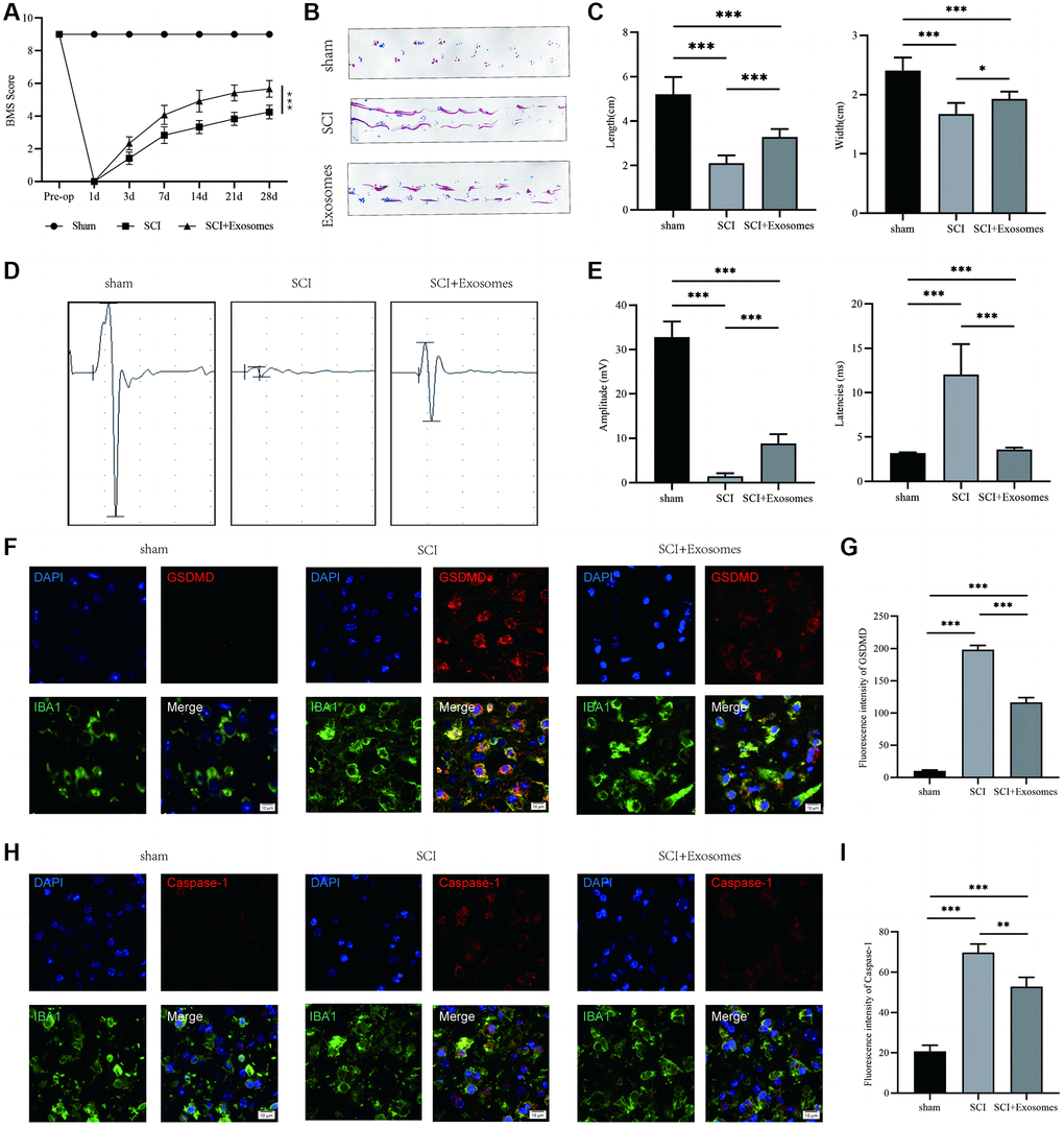 BMSCs-derived exosomes aid in the recovery of motor function and attenuate macrophage/microglia pyroptosis following SCI. (A) BMS was used to functionally grade mice in different groups on the 28th day after injury; (B) Footprint analysis demonstrated better functional recovery in the exosome-treated group; (C) The footprint quantification of mice walking after SCI (n = 6); (D) MEP analysis was used as electrophysiological assessment after SCI; (E) Quantification of MEP amplitudes and latencies in mice (n = 6); (F) Representative immunostaining images of IBA1 and GSDMD in mice on the 7th day after injury; (G) Quantification of fluorescence intensity; (H) Representative immunostaining images of IBA1 and Caspase-1 in mice on the 7th day after injury; (I) Quantification of fluorescence intensity (*p **p ***p 