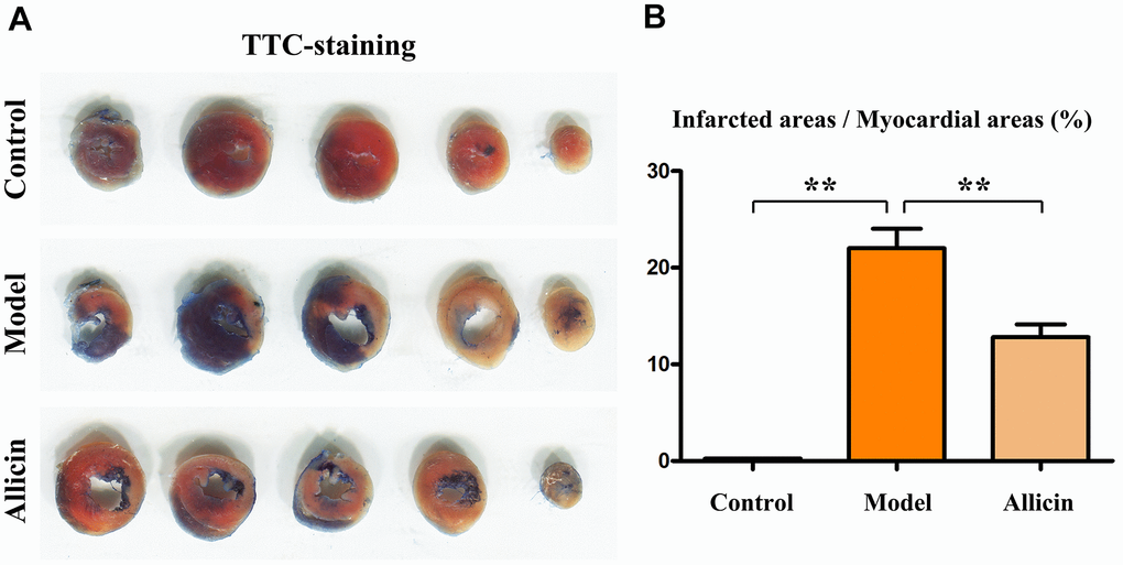 Size of myocardial infarction in TTC-stained mice. (A) TTC staining of the hearts in each group. (B) Statistical data on the ratio of TTC-positive area. One-way analysis, **p 