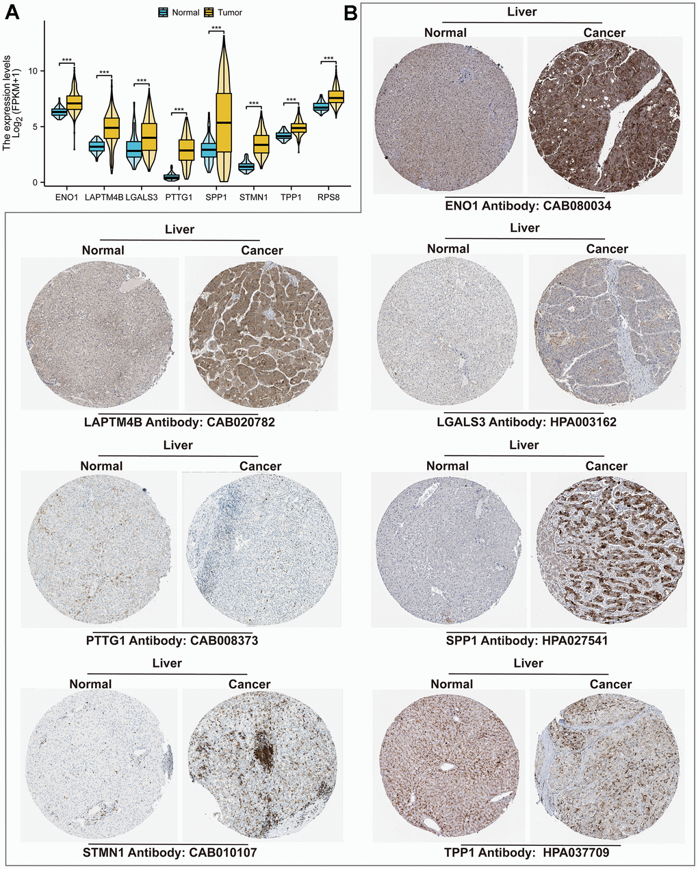 TRSSys-related genes in HCC. (A) Differential expression of TRSSys-related TRGs in tumor and normal tissues. (B) Immunohistochemical images of TRSSys-related TRGs in the HPA.